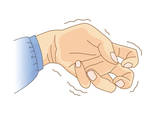 <a href=https://www.sanguangjiaoqifen.com/buy/ target=_blank class=infotextkey><a href=https://www.sanguangjiaoqifen.com/buy/ target=_blank class=infotextkey>手足癣</a></a>会引起耳鸣吗